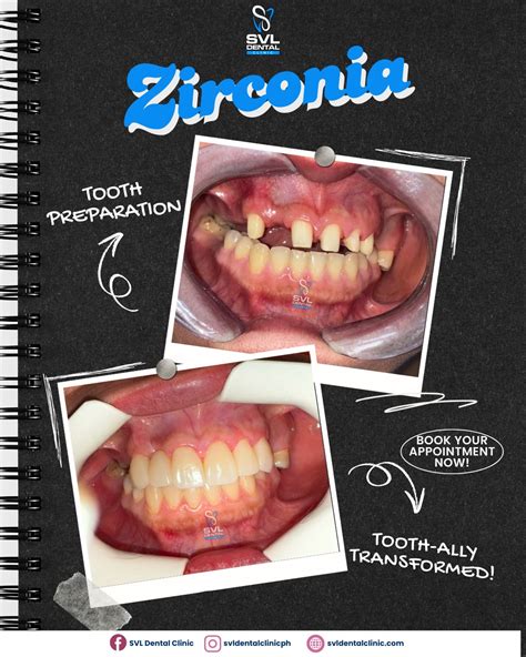 svl dental clinic caloocan|Come and visit SVL .